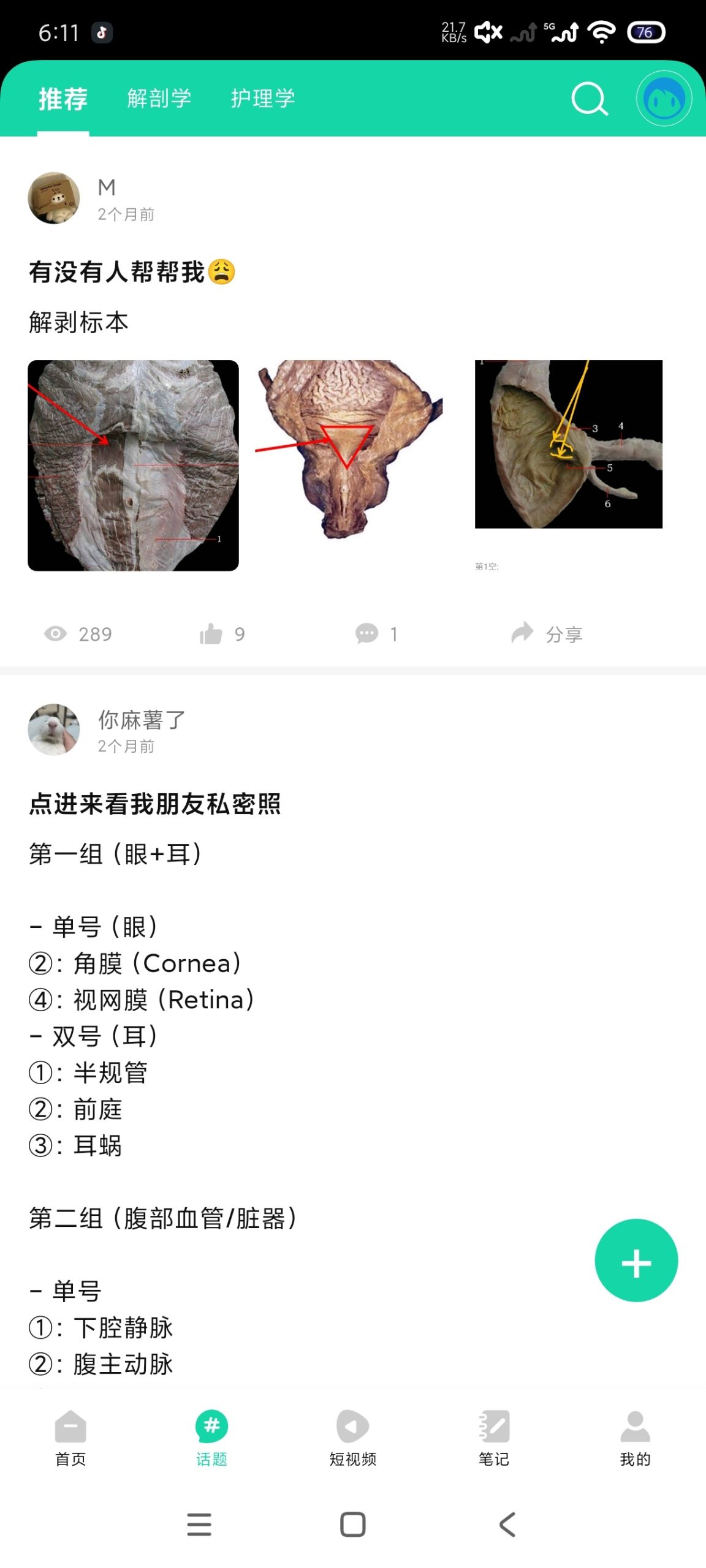 医维度解剖 3.3.21:基于人卫教材的高精度 3D 人体解剖软件评测插图4 医维度解剖 3.3.21:基于人卫教材的高精度 3D 人体解剖软件评测插图4